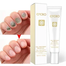 Efero Toe Nail Repair Cream Nail Fungus Removal Gel Anti Infection Nails Health Beauty Accessories Onychomycosis Nail Care TSML1 Efero Toe Nail Repair Cream Nail Fungus Removal Gel Anti Infection Nails Health Beauty Accessories Onychomycosis Nail Care TSML1