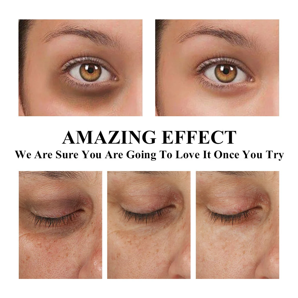 ascorbic acid under eyes