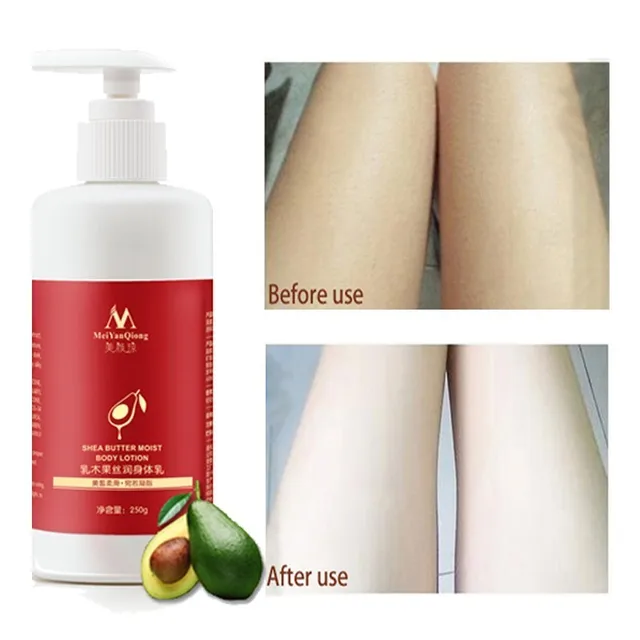 lotil moisturising cream for dry skin