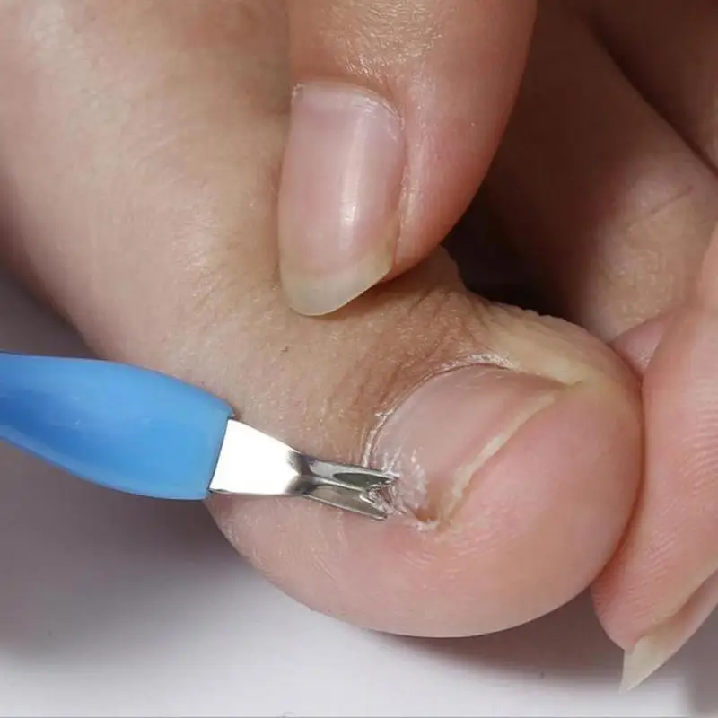 8 piezas de limas de uñas de doble cara de acero pedicura pie duro Seco piel muerta limpieza profesional herramientas de cuidado de los pies inoxidable 8 piezas de limas de uñas de doble cara de acero pedicura pie duro Seco piel muerta limpieza profesional herramientas de cuidado de los pies inoxidable