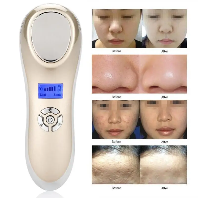 USB Kalten Heißer Schönheit Maschine Ultraschall Gesichts Vibration Massager Therapie Hautpflege Gerät für Poren Kontraktion Gesicht Schönheit Werkzeuge USB Kalten Heißer Schönheit Maschine Ultraschall Gesichts Vibration Massager Therapie Hautpflege Gerät für Poren Kontraktion Gesicht Schönheit Werkzeuge