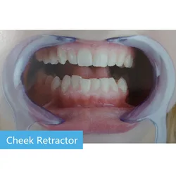 10 Unids Tipo C Abridor Bucal Enderezador de Dientes Labio Oral Abridor Abridor Dental Mejilla Retractor de Labios Abridor Bucal Modelo 10 Unids Tipo C Abridor Bucal Enderezador de Dientes Labio Oral Abridor Abridor Dental Mejilla Retractor de Labios Abridor Bucal Modelo