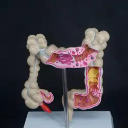 Анатомические модели толстой кишки большой кишечник патологический анатомическая модель медицинский орган модель для изучения анатомии
