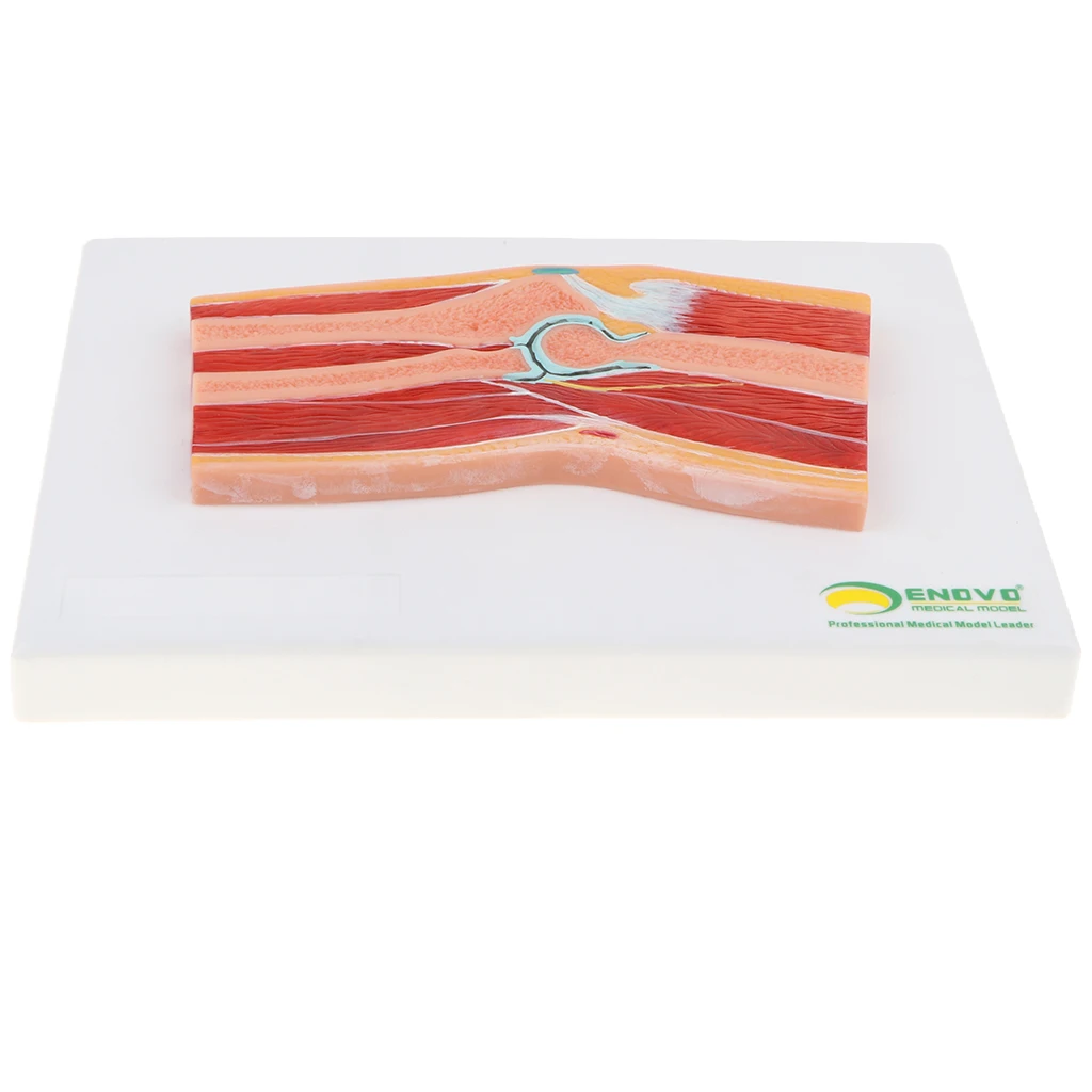 

1:1 Advanced Human Elbow Joint Muscle Skeleton MRI Section Medical Model School Teaching Lab Supplies