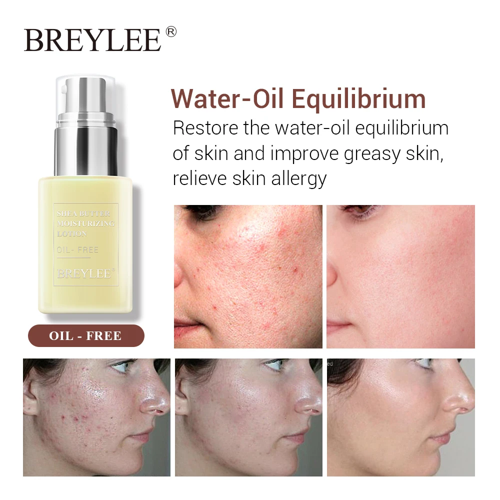 Breylee Face Cream Shea Butter Moisturizing Lotion Skin Care Anti Acne Treatment Facial Emulsion Easy To Absorb Day Night Cream