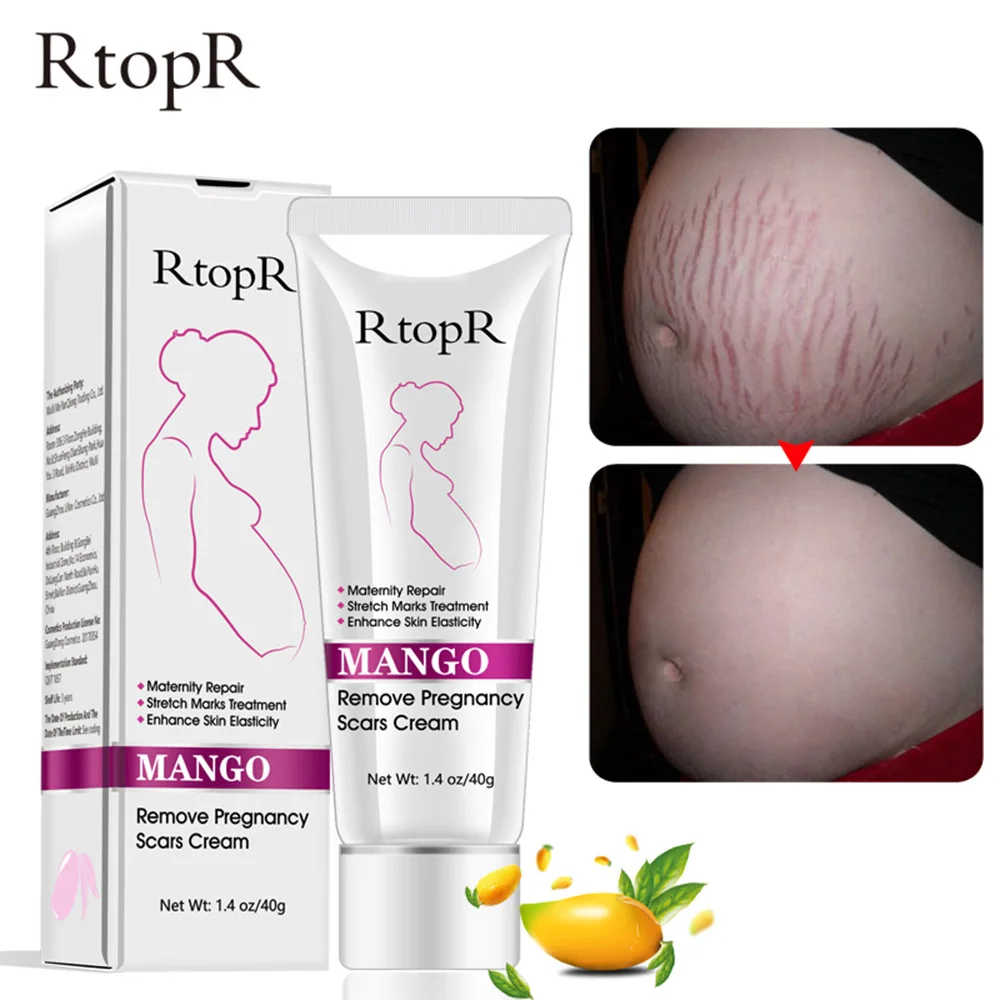 

RtopR Mango Remove Pregnancy Scars Acne Cream Stretch Marks Treatment Maternity Repair Anti-Aging Skin Firming Body Creams