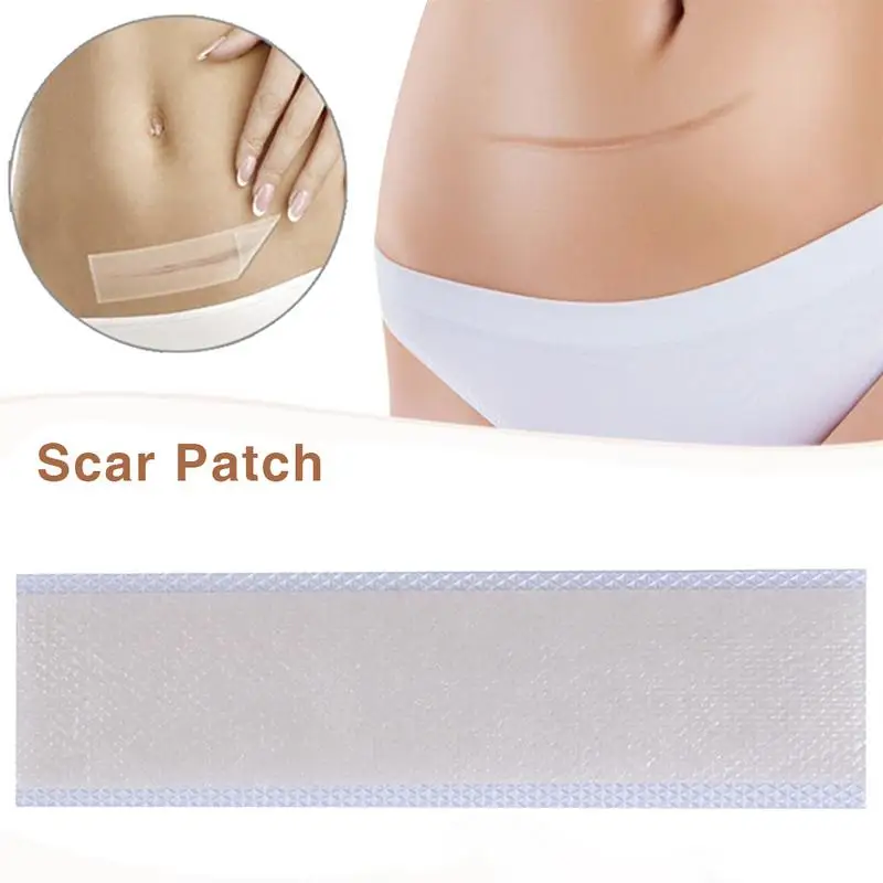 

Silicone Scar Removal Patch Remove Trauma Burn Scar Sheet Skin Repair Scar Removal Therapy Patch for Acne Scar Treatment