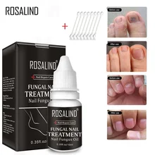 10 мл грибковое масло для ногтей с ватными тампонами для устранения проблем с ногтями питательный раствор для ухода за ногтями ног масло для ухода за ногами TSLM2