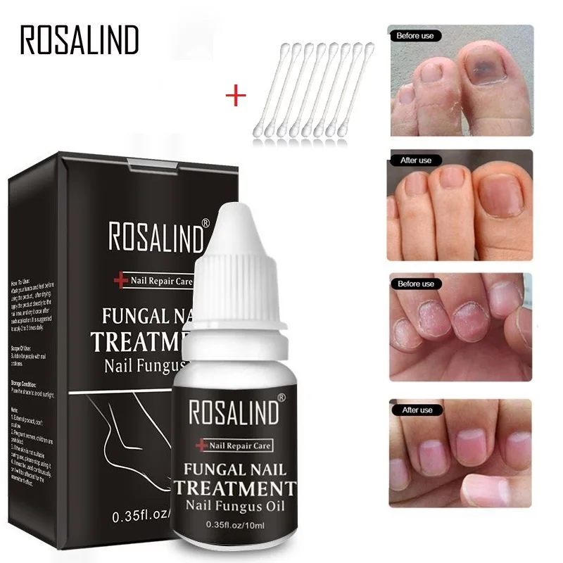 

10ML Nail Fungus Oil with Cotton Swabs Repair Nails Problems Nutrient Solution Toe Nail Treatment Essence Oil Feet Care TSLM2