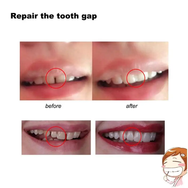10g 100g Denture Solid Glue Dental Restoration Temporary Tooth Repair Kit Adhesive Dental Restoration Oral Care 5