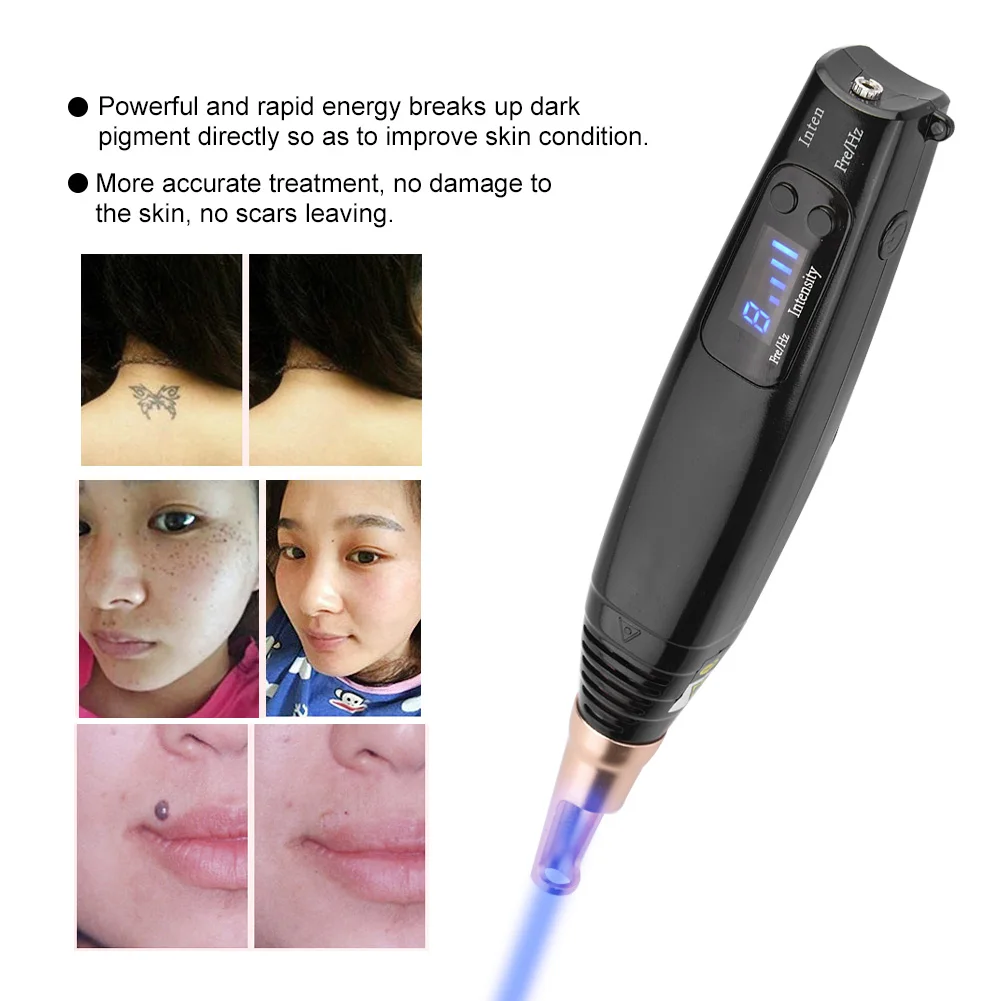 

Scar Tattoo Removal Laser Pen Freckle Acne Mole Dark Spot Pigment Tattoo Removal Beauty Machine Pro Repair Picosecond Pen 5