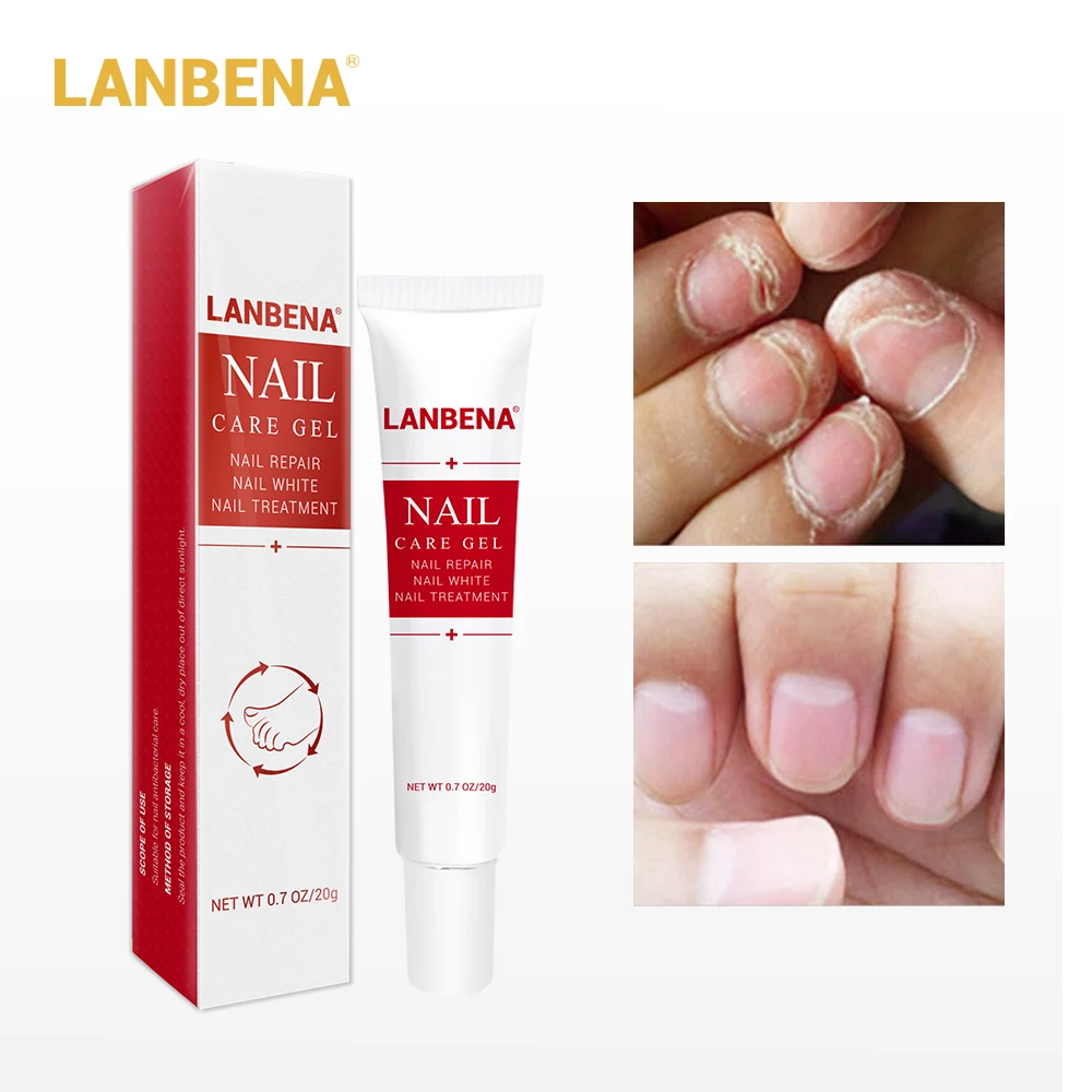 Гель LANBENA для ухода за ногтями лечение грибковых ногтей Удаление онихомикоза