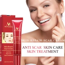 Высокое качество травяное Очищение лица против акне лечение травяной крем удаление шрамов жирная маска для носа против черных точек пятна для ухода за кожей лица