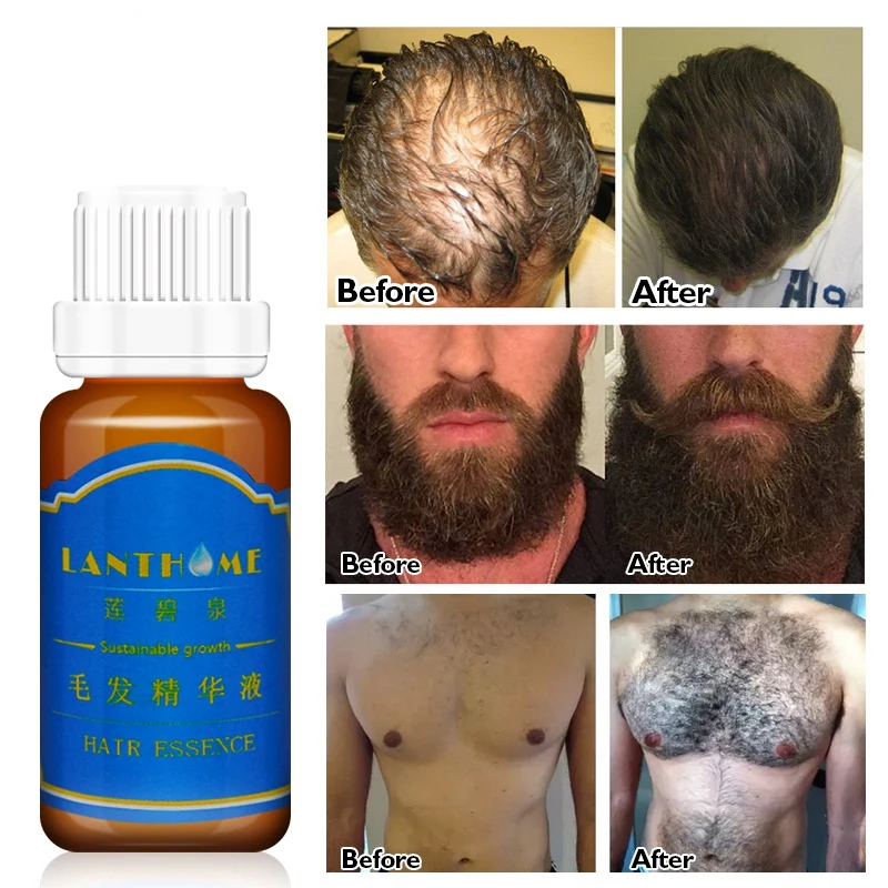 LANTHOME мужское масло для роста бороды бровей усилитель роста груди роста волос более толстая эссенция выпадения волос лечение мужчин t Сыворотка для волос 20 мл