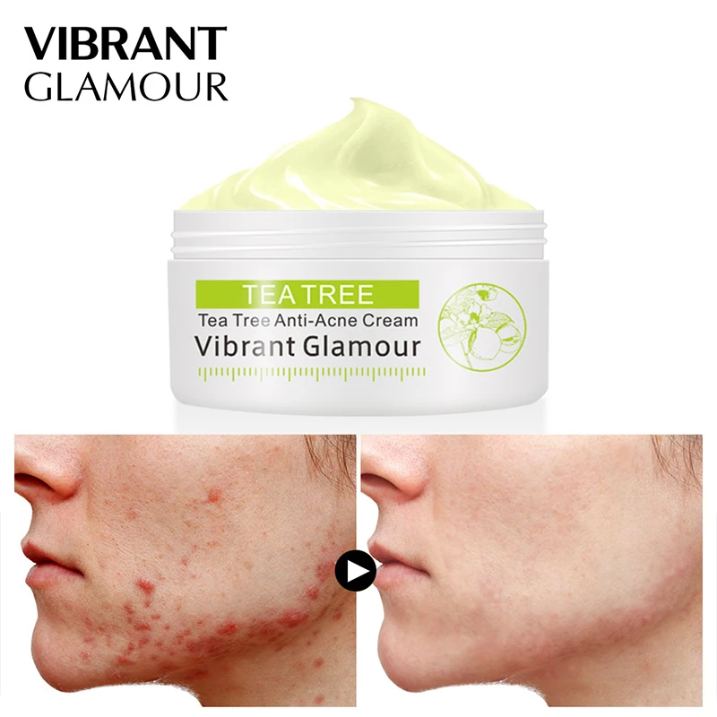 

Tea Tree Anti-Acne Face Cream Acne Scar Cream Shrink Pores Facial Eliminates Acnes Cream Oil Control Repair Spot Skin Care