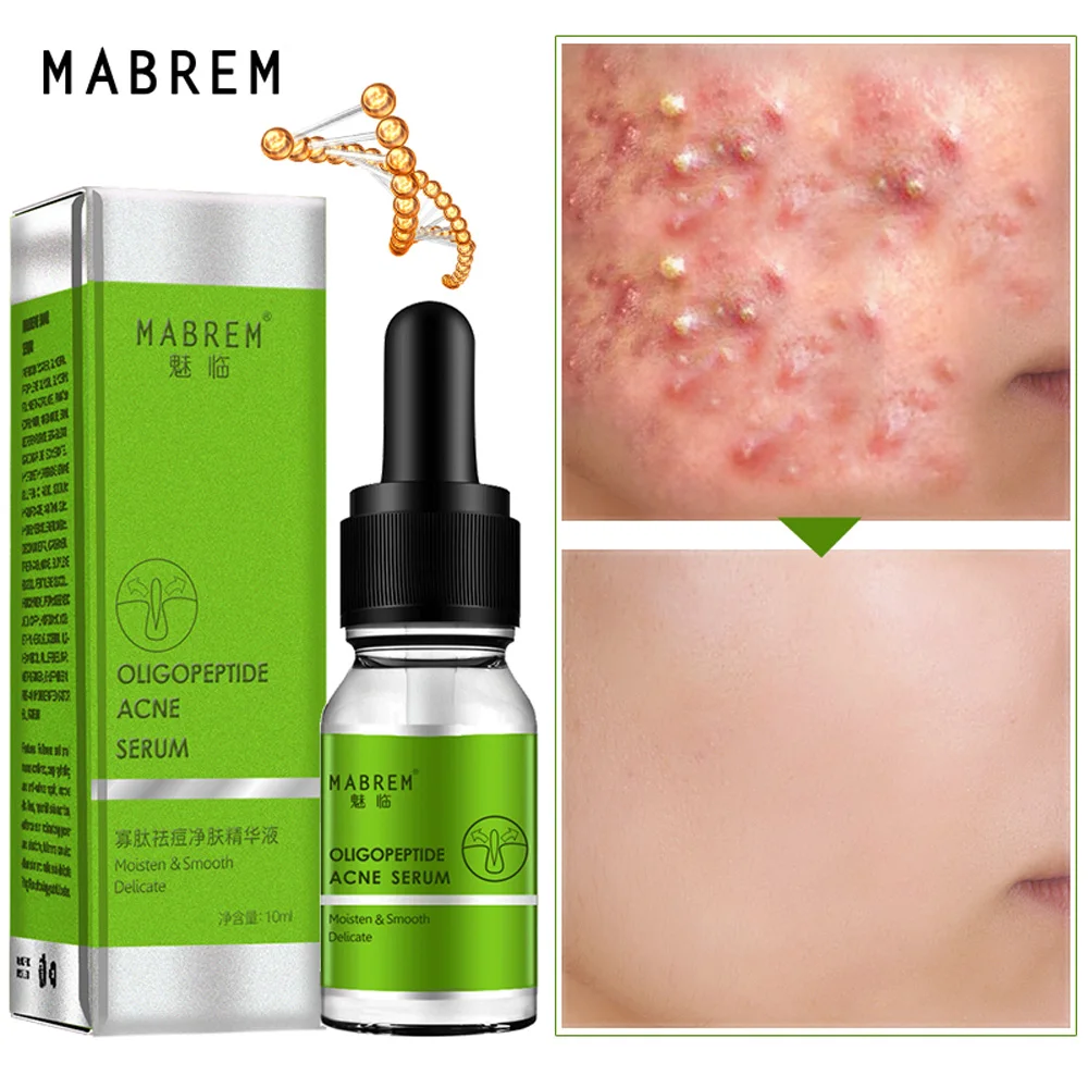 

MABREM 10ML Oligopeptide Acne Cleaning Lotion Serum Acne Treatment Cream Pore Repair Whitening Moisturizing Essence
