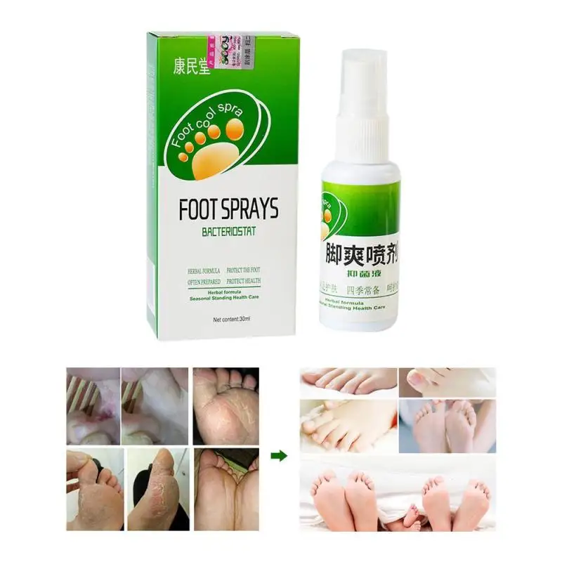 Foot odor Treatment Spray Remove Fungus Removal Relieve Itching