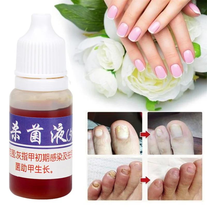 10 мл Лечение грибка для здоровья ногтей жидкое масло для ухода за ногтями дезинфицирующие продукты для удаления и очистки ногтей Onychomycosis TSLM2