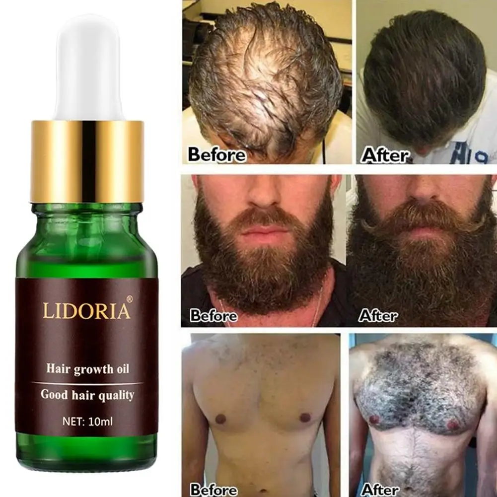 

10ml Hair Growth Essential Oil Anti Drying Nourishing Repairing Scalp Treatment New
