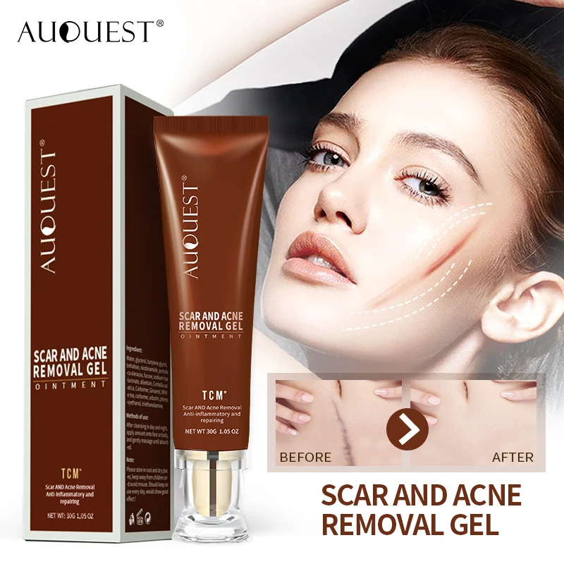 AUQUEST Face Cream Ginseng Extract Remove Acne Scars Repair Gel Red Spots Moisturizing Cream Stretch Marks Whitening Skin Care