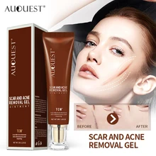 AUQUEST Face Cream Ginseng Extract Remove Acne Scars Repair Gel Red Spots Moisturizing Cream Stretch Marks Whitening Skin Care