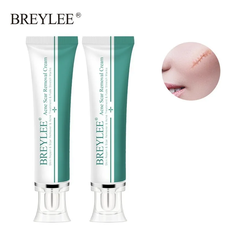 BREYLEE 2 шт. крем для удаления шрамов от акне лица Уход за кожей шрам лечение