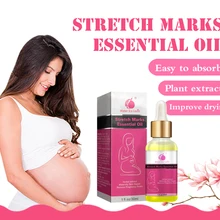 30 мл мощное средство для Удаления растяжек эфирное масло для удаления шрамов при беременности крем для восстановления гладкой кожи тела CreamTSLM1