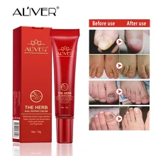 Gel para Tratamento para fungos na unha, Clareador para Pés, Removedor de Fungo nos Dedos e Unhas, Cuidado para Unha Frete Grátis(China)