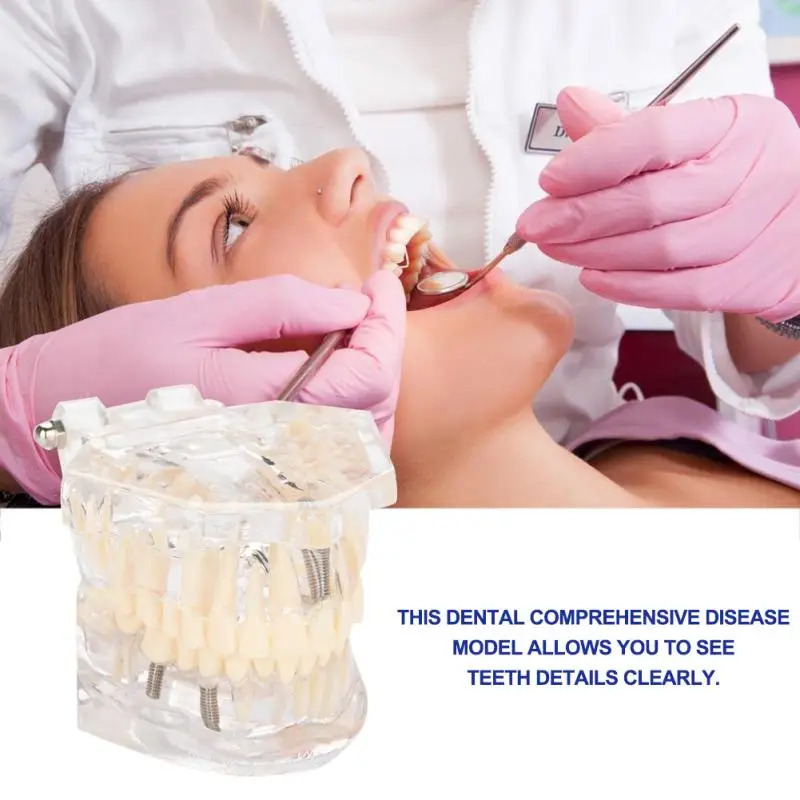 

Comprehensive Dental Practice Teaching Model Transparent Nerve Removable Model For Medical Science Dental Disease Teaching Study