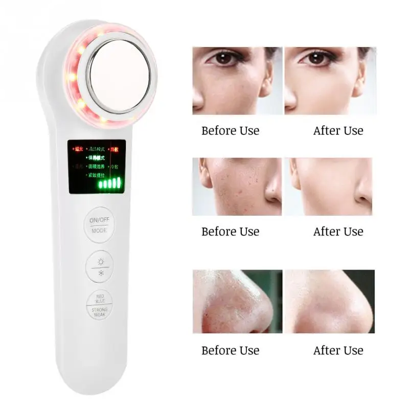 ColdHot Compress Anti-aging Instrument Ultrasonic Ion Importing Massager Wrinkle Removal Skin Lift Care Machine | Красота и здоровье