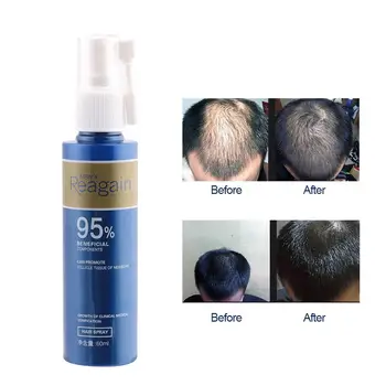 

60ml Hair Growth Essence Nourishing Scalp Hair Loss Treatment Liquid Pilatory n