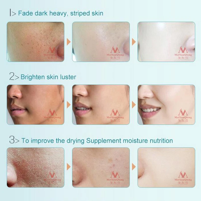 Vitamin C Whitening Anti Wrinkle Facial Serum Anti Aging Moisturzing Serum Face Care VC Remove Dark 3