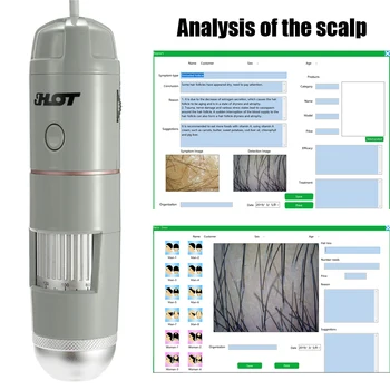 

HT-B30S 5-200X Adjustable HD Skin and Hair Follicles of the Scalp Detector Household Portable Skins Tester can be Photoed