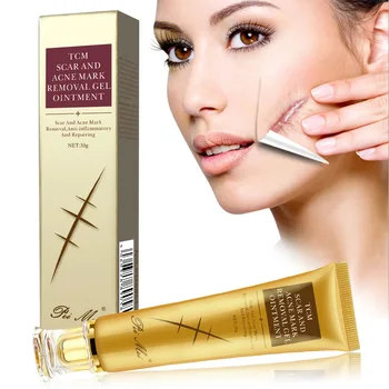 preço 30g Remoção Da Cicatriz Da Acne Creme De Reparação Da Pele Creme Para O Rosto Manchas De Acne Tratamento Da Acne Cravo Whitening Creme Para As Estrias DROPSHIPPING