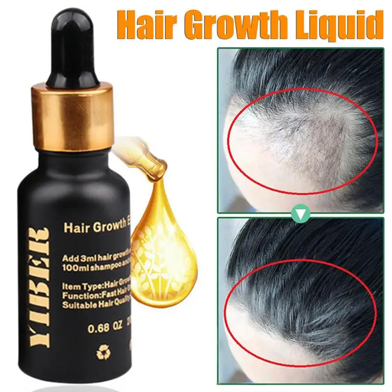 Effective Anti Hair Loss Hair Growth Liquid Women Men Hair Regrowth Dry Hair Repair Moisturizer Treatment Serum 20ml
