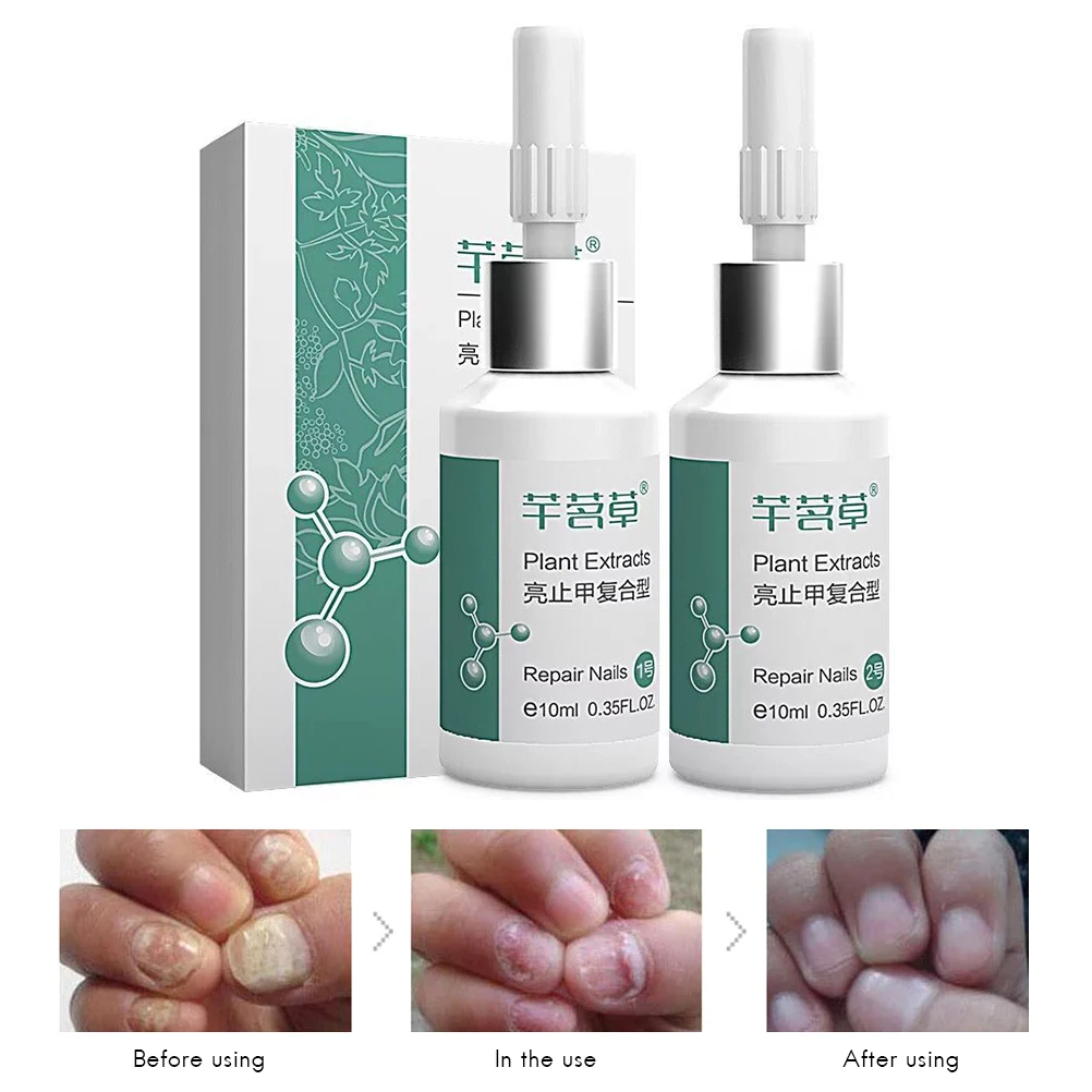 55g Nail Treatment Liquid Antifungal Nail Repair Bright Toe Finger