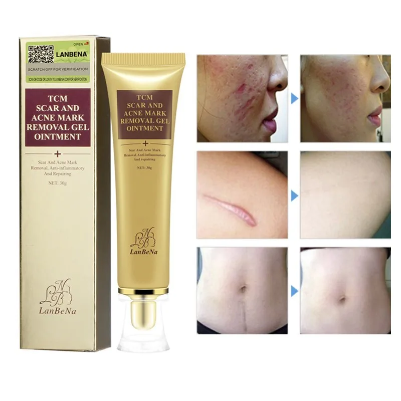 

LANBENA Acne Scar Removal Cream Face Cream Skin Repair Spots Acne Treatment Blackhead Whitening Cream Stretch Marks Foundation