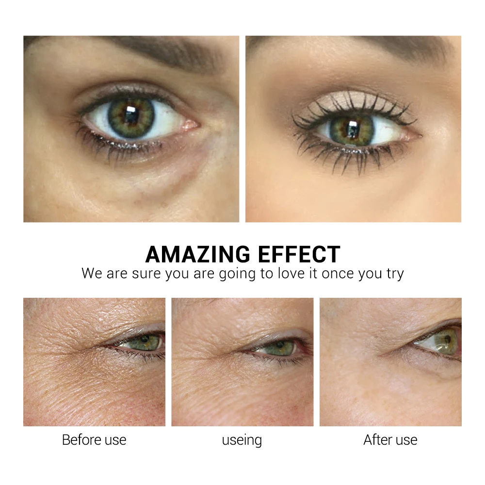 LANBENA Retinol Eye Mask Hyaluronic Acid Eye Patches Serum Reduces Dark Circles Bags Eye Lines Repair Nourish Firming Skin Care LANBENA Retinol Eye Mask Hyaluronic Acid Eye Patches Serum Reduces Dark Circles Bags Eye Lines Repair Nourish Firming Skin Care
