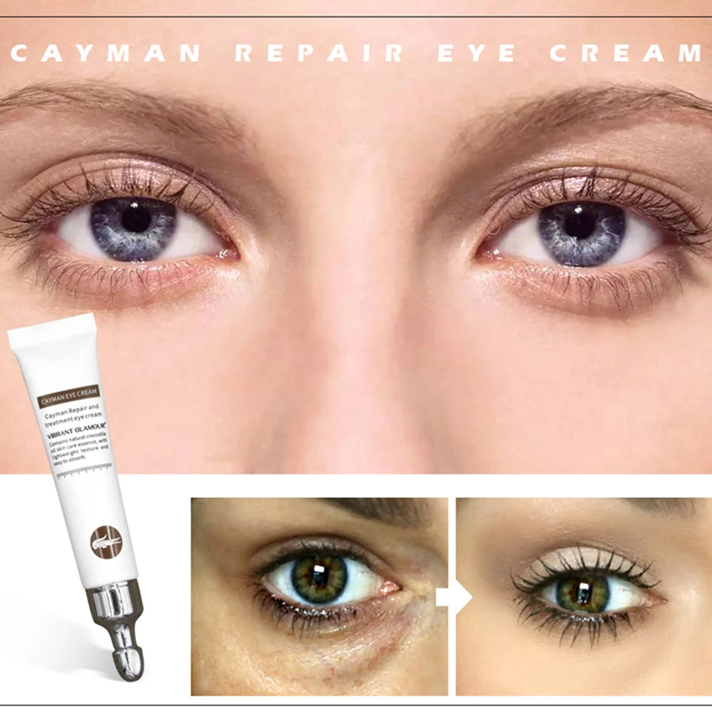 

VIBRANT GLAMOUR Anti Wrinkle Eye Cream Moisturizing Remover Dark Circles Against Puffiness Bags Anti-aging Eye Care Fat Granule