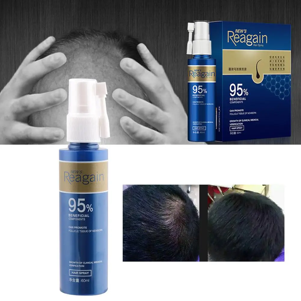 60 мл средство для роста волос питательное средство для похудения кожи головы