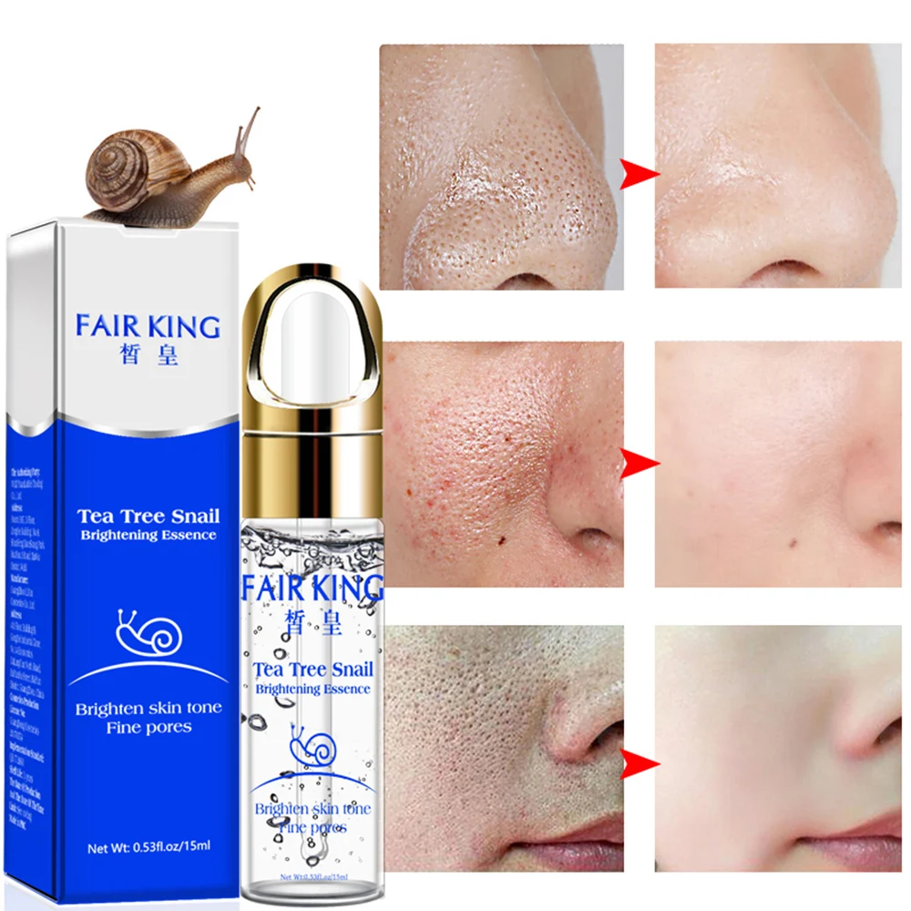 

15ml Tea Tree Extract Snail Brightening Essence Nourish Skin