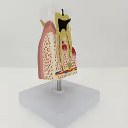 Человека больные зубы анатомическая модель для медиков Анатомия для пациентов Учебные ресурсы
