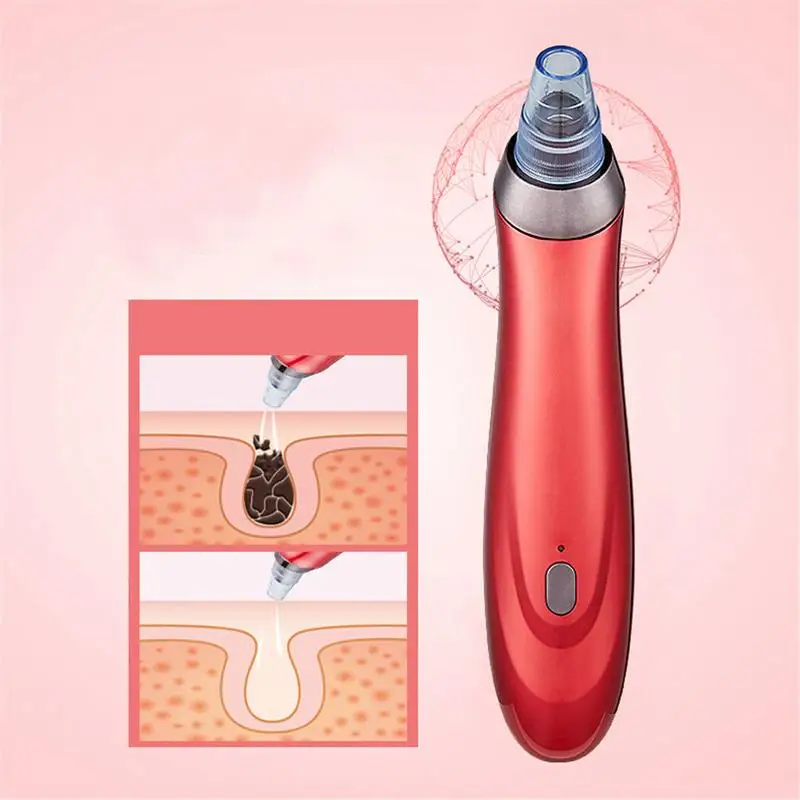 Инструмент для удаления черных точек Электрический Blackhead артефакт очиститель