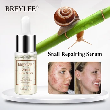 

Breylee Snail Repairing Serum Scars Acne Treatment Liquid Anti-acne Rejuvenation Essence Face Skin Care Nourishing Moisturizing