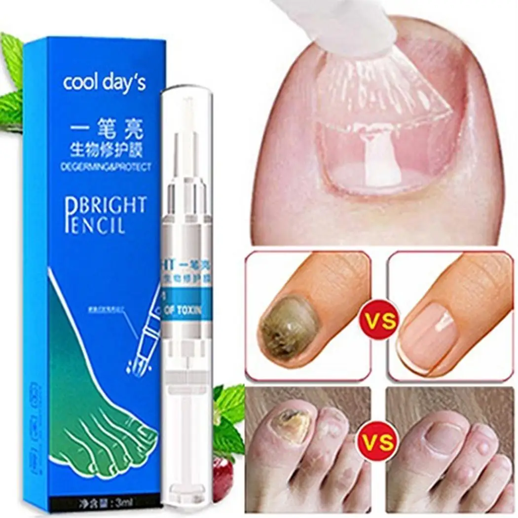 Nail Treatment Pen for Remove Fungus The bottle is small and easy to carry. Natural Biological Repair | Красота и здоровье