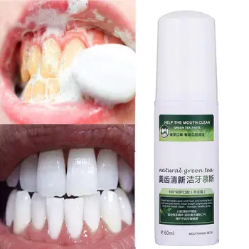

60ml Teeth Cleansing Foaming Cleanser Tartar Removal Solution Breath Oral Care