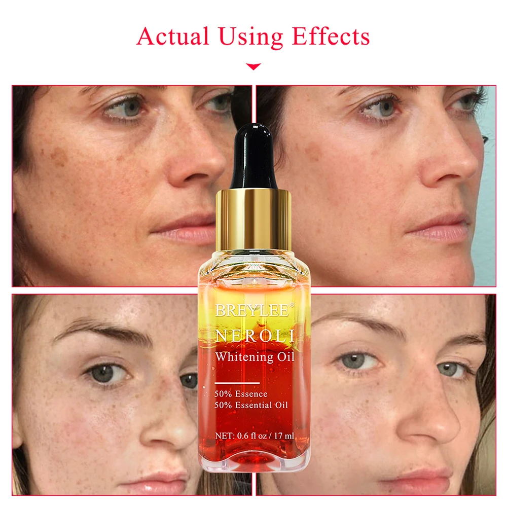 Breylee Neroli Whitening Essential Oils Fade Dark Spots Remove Face Freckle Brighten Skin Facial Serum Moisturizer Essence Oil