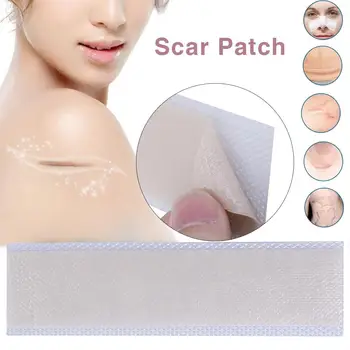 

3.5x15cm Silicone Gel Scar Sheet Removal Patch Wound Marks Reusable Acne Gel Burn Scar Therapy Sheet Skin Repair Scar Treatment
