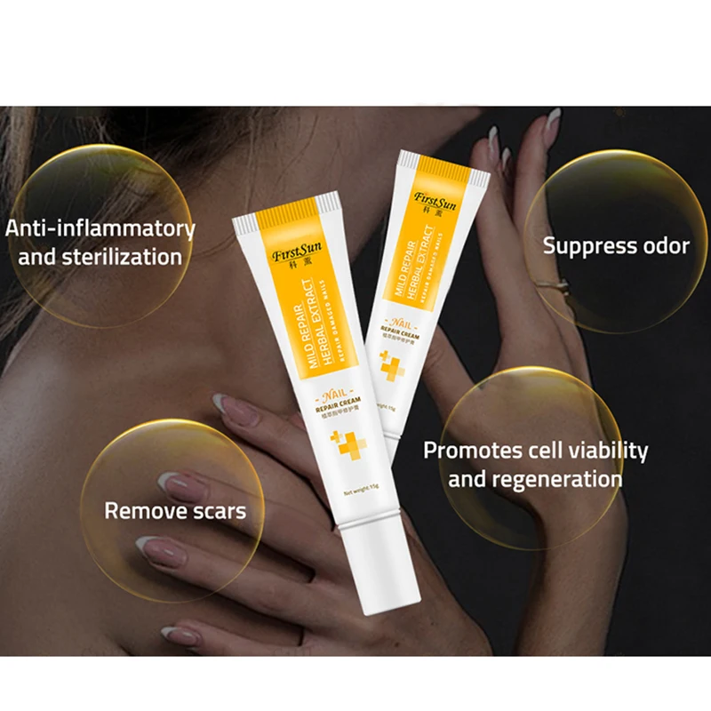 Анти Лечение ногтей от грибка крем палец ног ногти грибок Onychomycosis Remover|Средства