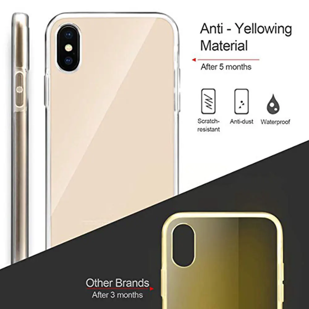  KISSCASE 360 Volle Abdeckung Fall für iPhone X XS MAX XR 7 8 Weiche TPU Acryl Schutz Telefon Tasche